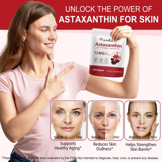 Vrouw wijst naar een flesje Astaxanthine 12 MG 120 softgels. Voor en na foto's tonen gezondere huid.