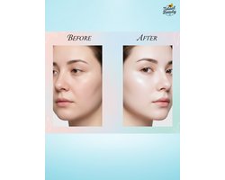 Belo Face Advantage Pack – Complete gezichtsverzorgingsset – Verheldert, Hydrateert & Egaliseert de Huidtint – Vermindert Onvolkomenheden & Geeft een Stralende, Gladde & Gezonde Huid