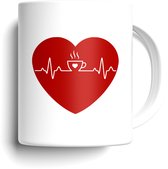 Tasse à café - Céramique - 325 ml (11 oz)