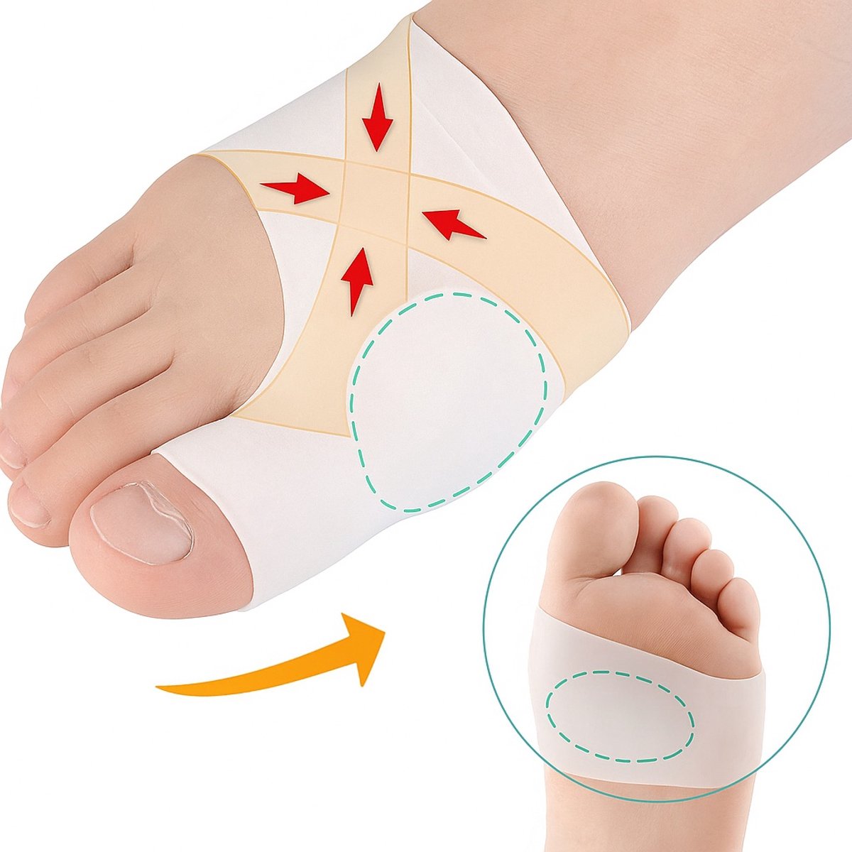 Goedkoopste Hallux Valgus Siliconen Teenbeschermers I Teenspreiders I Teen Corrector I Knobbel I Bunion I Eeltknobbel | Teen Rechtzetten I 1 Paar I Wit