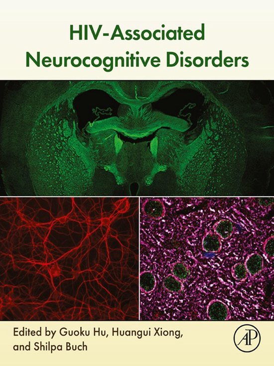 HIV-Associated Neurocognitive Disorders - cover