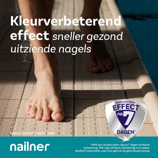 Mannenvoeten op een lichte tegelvloer. Nailner heeft een kleurverbeterend effect voor sneller gezond uitziende nagels.
