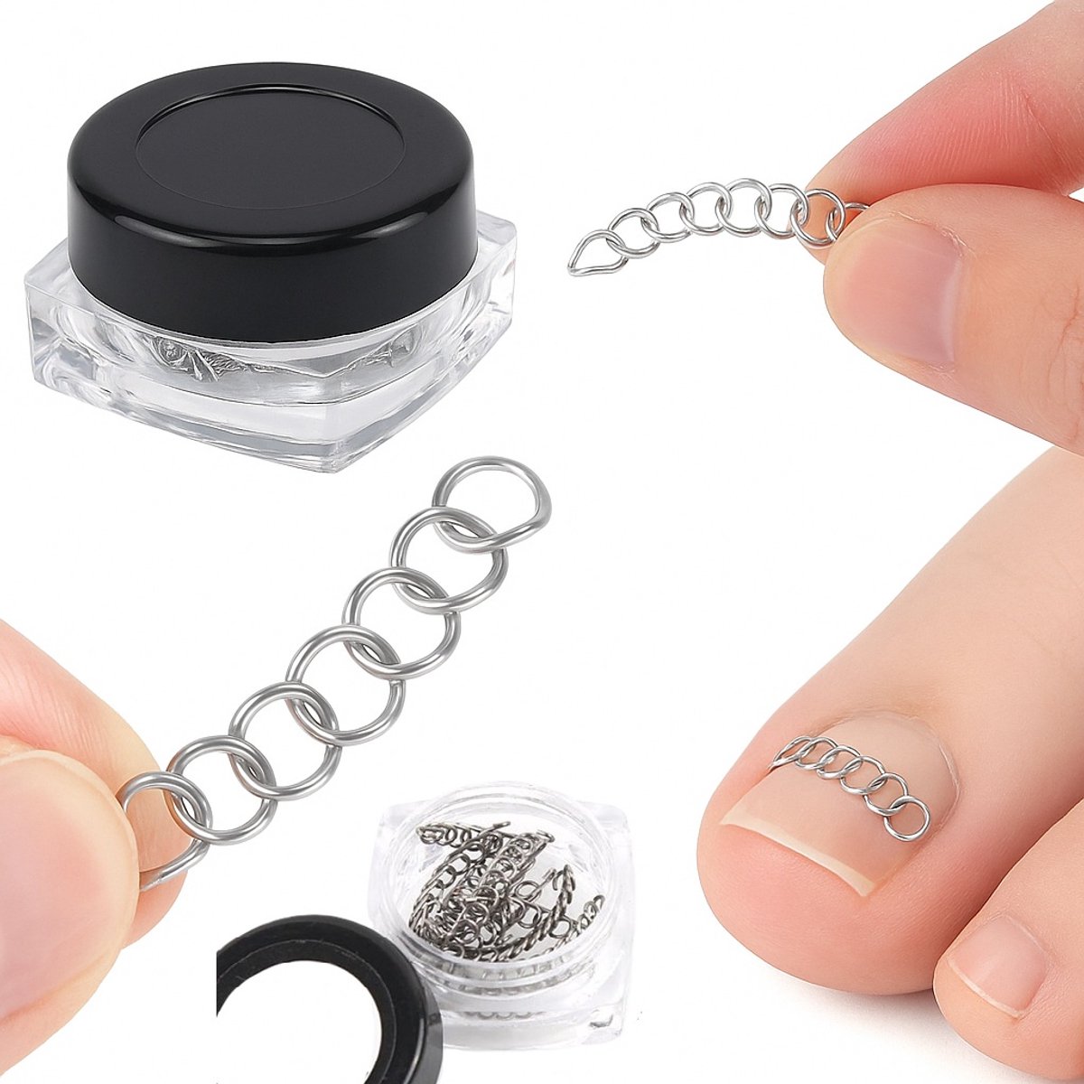 Goedkoopste Nagelbeugeltjes Tegen Ingegroeide Teennagels I Teennagel Corrector I Teennagel Lift I Teennagel Beugeltjes I Siliconen I Voor Alle Tenen I 12 Stuks