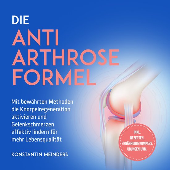 Die Anti Arthrose Formel: Mit bewährten Methoden die Knorpe ... - cover