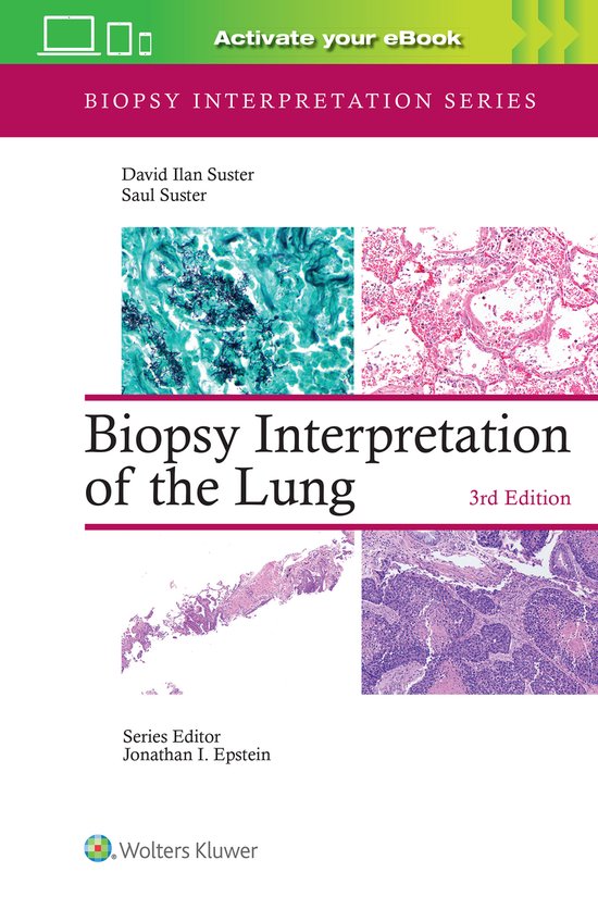 Biopsy Interpretation Series- Biopsy Interpretation of the L ... - cover