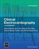 Clinical Electrocardiography