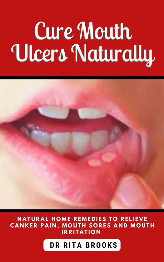 CURE MOUTH ULCERS NATURALLY (ebook), Dr. Rita Brooks 1230006354008