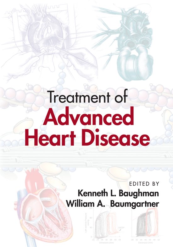 Boekomslag 'Treatment of Advanced Heart Disease' met medische illustraties van het hart en grafieken.
