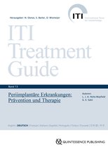 ITI Treatment Guide Series - Periimplantäre Erkrankungen