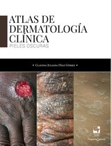 Salud - Atlas de dermatología clínica
