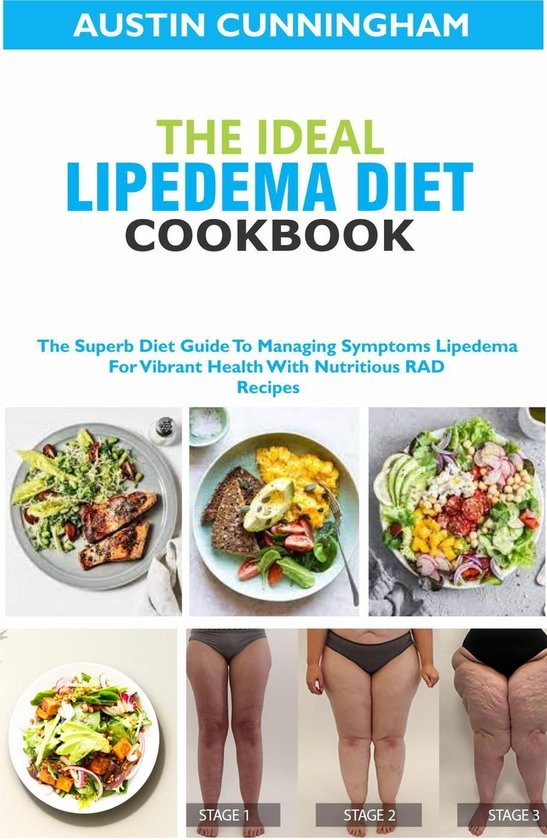 The Ideal Lipedema Diet Cookbook The Superb Diet Guide To Managing