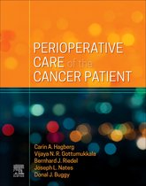 Perioperative Care of the Cancer Patient E-Book