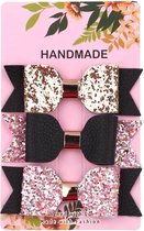 Glitter Goud Zwart Roze Strik Haarclip Haarspeld/Haarklem - meisje haaraccessoires set van 3