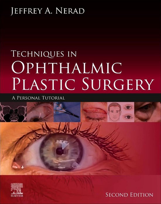 Techniques in Ophthalmic Plastic Surgery E-Book - cover