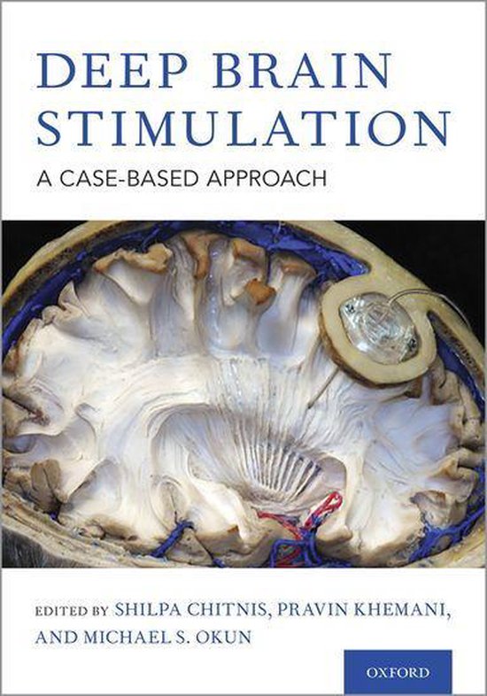 Deep Brain Stimulation (ebook) | 9780190647223 | Boeken | bol.com