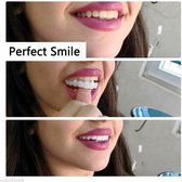 Kunstgebit | SnapOnSmile | Mooie tanden | Tand reparatie | Facings | Kunst tanden | Nep gebit