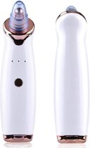 Beauty Star Elektrische Vacuum Mee-eter Verwijderaar - poriën en mee-eterreiniger - blackhead remover - puistjes  - Inclusief 5 Opzetstukken