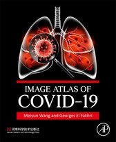 Image Atlas of COVID-19