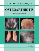 Oesteoarthritis