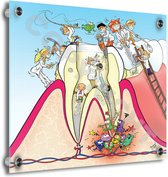 Tandarts Cartoon op plexiglas - Uniek ontwerp - Roland Hols - Doorsnede kies - 80 x 80 cm - 5 mm dik - inclusief 4 afstandhouders chroom (zilverkleurig) - Decoratie - Orthodontist - Mondhygiënist