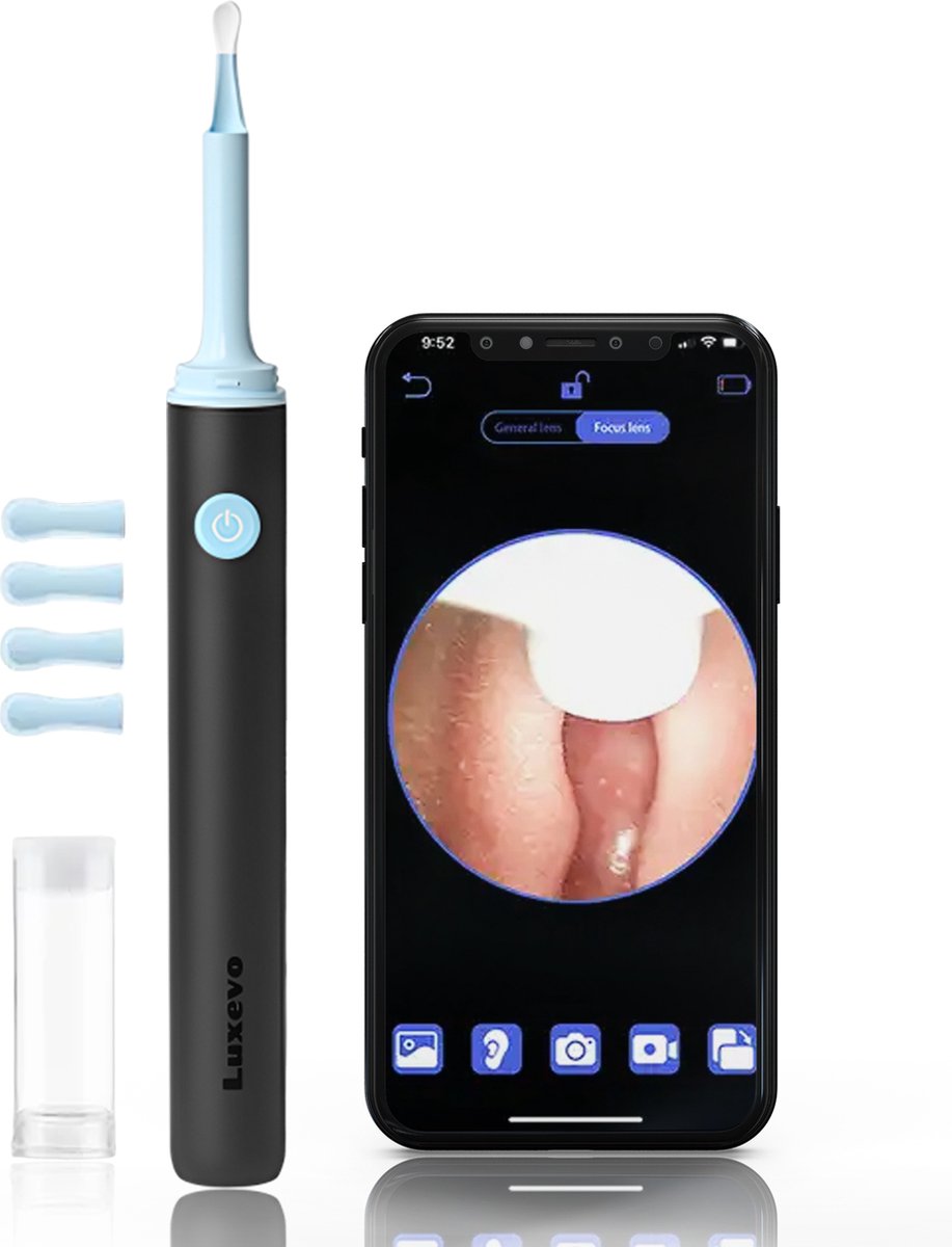 Goedkoopste Luxevo Oorreiniger met Camera - Efficiënte Oorsmeer Verwijderaar - USB C Oplaadbaar - Gebruiksvriendelijk & Hygiënisch - Zwart