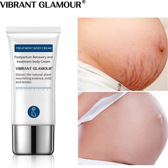 VIBRANT GLAMOUR Anti Striae creme
