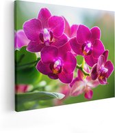 Artaza Canvas Schilderij Roze Orchidee Bloemen - 50x40 - Foto Op Canvas - Canvas Print