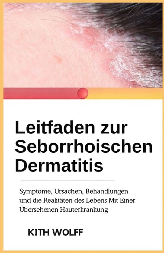 Leitfaden zur seborrhoischen - cover