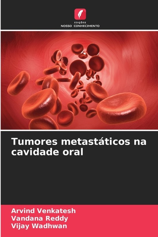 Tumores metastáticos na cavidade oral, Arvind Venkatesh | 9786209148590 ...