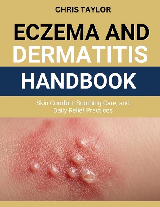 Eczema & Dermatitis Handbook