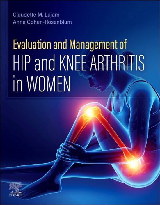 Evaluation and Management of Hip and Knee Arthritis in Women - cover