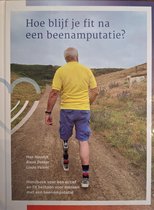 Hoe blijf je fit na een beenamputatie?