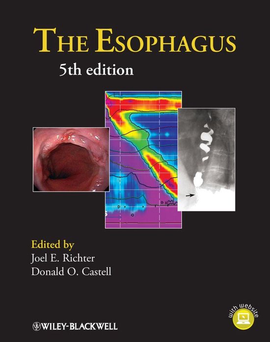 The Esophagus - cover