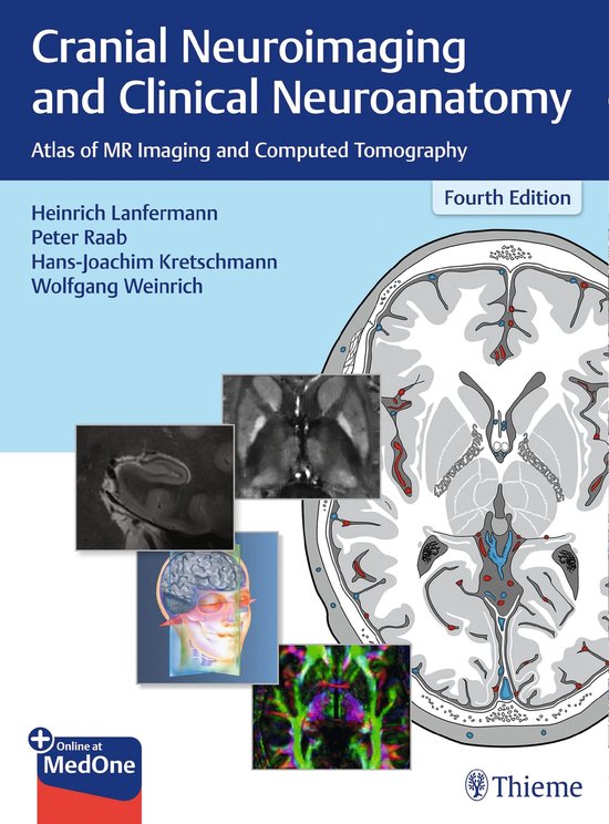 Cranial Neuroimaging and Clinical Neuroanatomy - cover