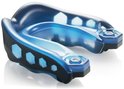 Blauw-zwarte mondbeschermer met glanzende transparante bovenkant en hexagonale openingen.