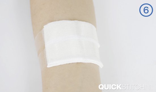 QuickStitch dubbele Hechtpleister – Naaldloze Hechting – pleister voor