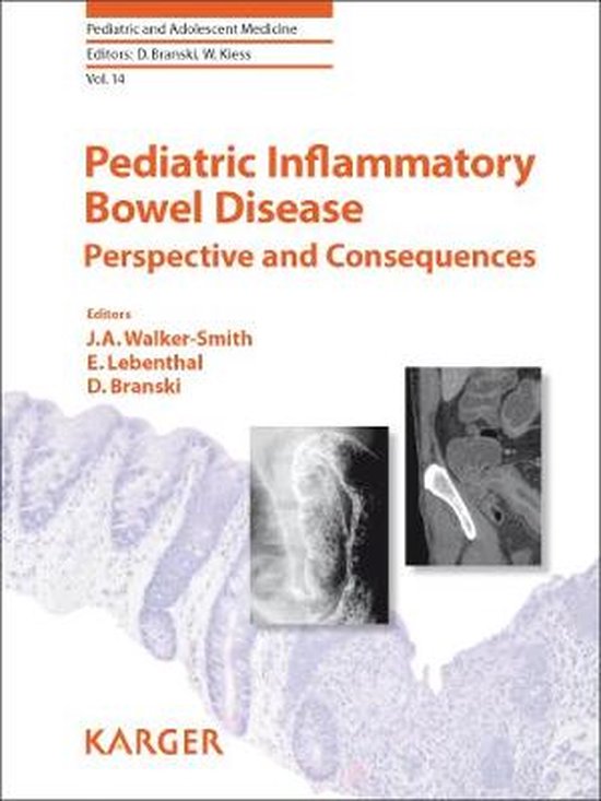 Perspectives of Pediatric Inflammatory Bowel Disease - cover