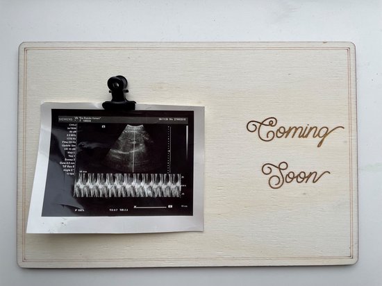 Annonce de grossesse avec photo - Panneau photo échographique - Bébé