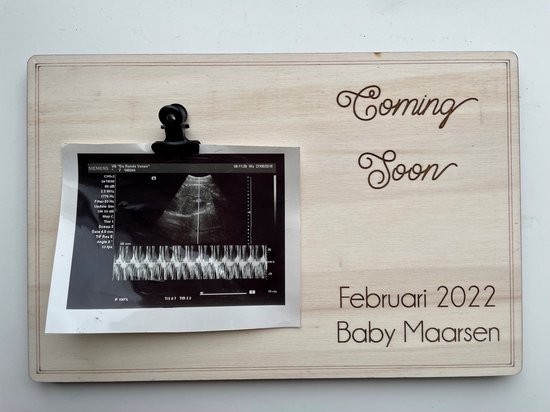 Zwangerschapsaankonding gepersonaliseerd - Bordje voor echo foto - Baby op komst