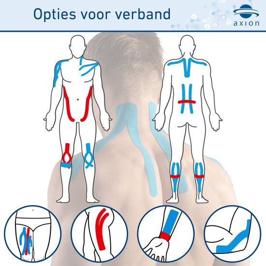 Schematische weergave van het aanbrengen van kinesiologie tape op het lichaam.