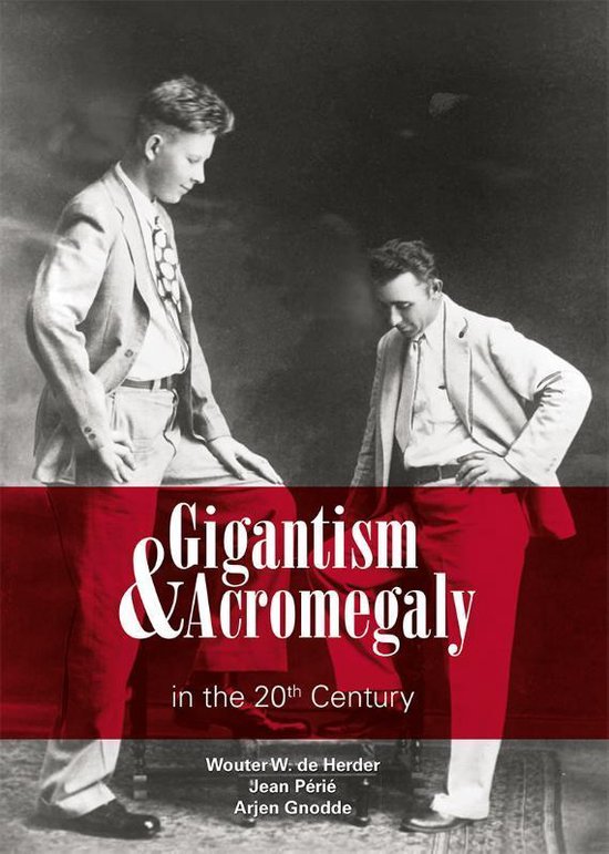 Gigantism & Acromegaly