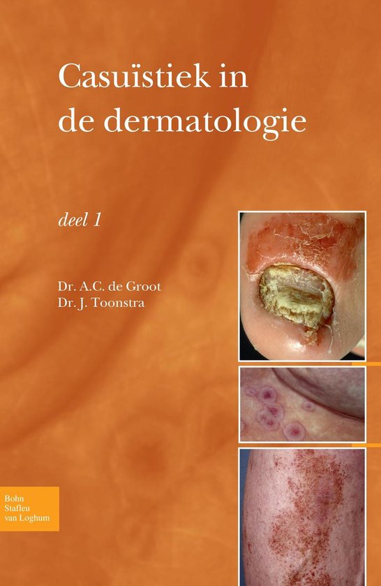 Dutch language eBook collection - Casuïstiek in de dermatol ... - cover