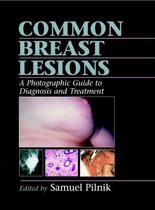 Common Breast Lesions