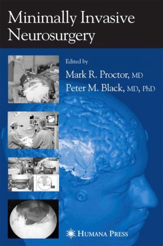 Minimally Invasive Neurosurgery - cover