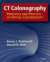 CT Colonography: Principles and Practice of Virtual Colonoscopy