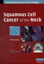 Squamous Cell Cancer Of The Neck