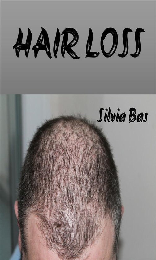 Hair Loss - cover