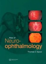Atlas Of Neuro-Opthalmology