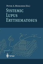 Systemic Lupus Erythematosus