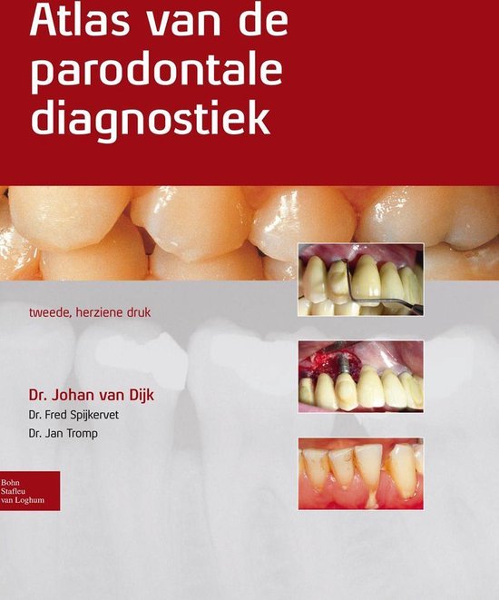 Atlas van de parodontale diagnostiek